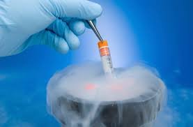 Embryologist retrieving a vitrified specimen vial with forceps